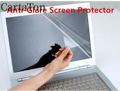 2 шт., матовая защитная пленка – обзор и цена Matte Anti Glare Screen Protector